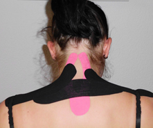 Kinesio-Taping-Therapie, medikamentenfrei Behandlungstherapie, Physiotherapie Susen Birnstein in Zeulenroada